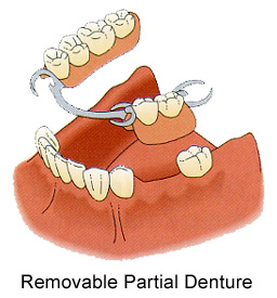 partial-d